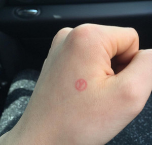 thumbimg