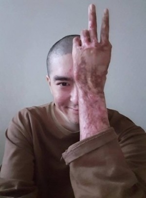 thumbimg