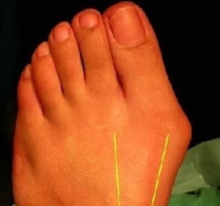 thumbimg