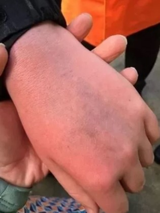 thumbimg